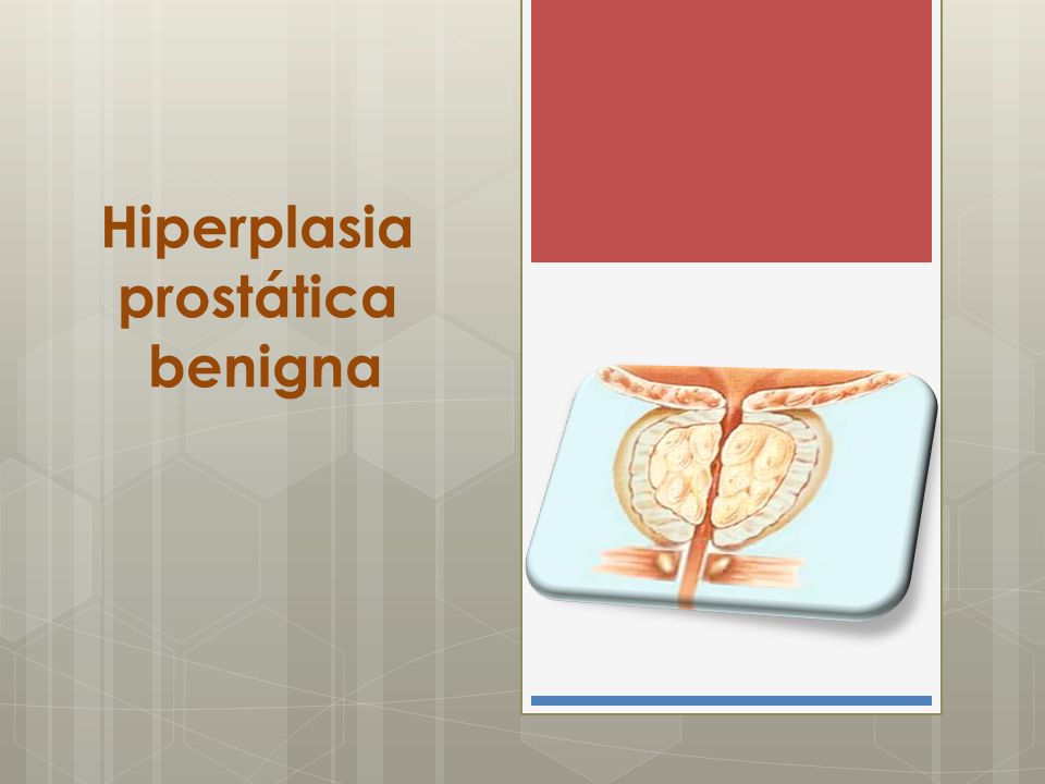manejo de la impotencia prostática ca